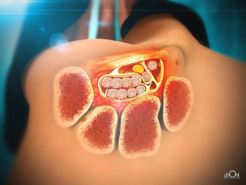 Carpal Tunnel Medical illustration